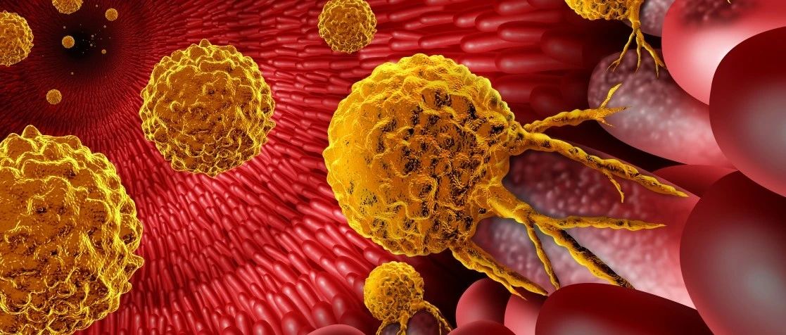 Nature：早期结肠癌细胞如何逃避免疫系统？