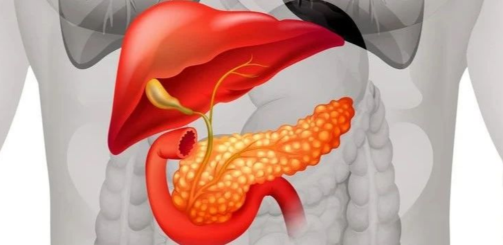 JCO丨国际专家述评：DC疫苗治疗胰腺癌2年RFS率达到64%，未来可期