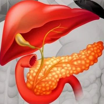 JCO丨国际专家述评：DC疫苗治疗胰腺癌2年RFS率达到64%，未来可期