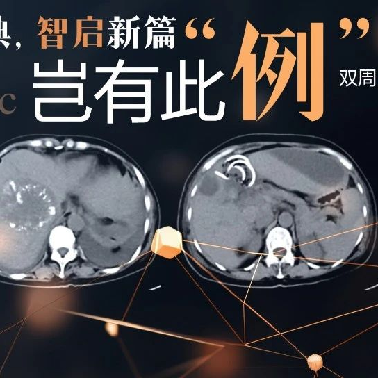 岂有此“例”丨颠覆认知！C期左肝全累及+门静脉侵犯HCC，手术切除实现6年无复发生存