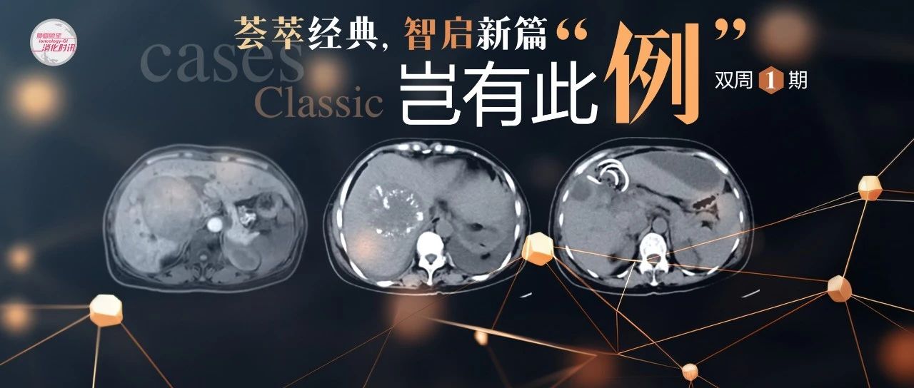岂有此“例”丨颠覆认知！C期左肝全累及+门静脉侵犯HCC，手术切除实现6年无复发生存