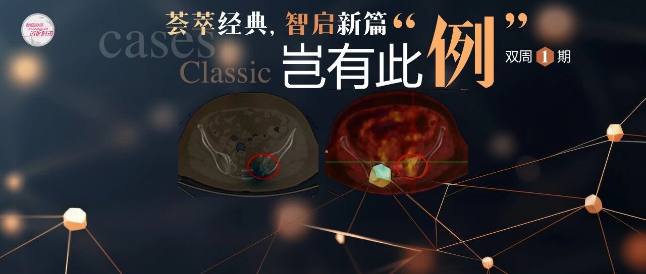岂有此例丨骨转移还是放射性骨炎？两例晚期结直肠癌孤立性骨病变MDT分享