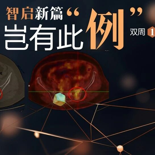 岂有此例丨骨转移还是放射性骨炎？两例晚期结直肠癌孤立性骨病变MDT分享