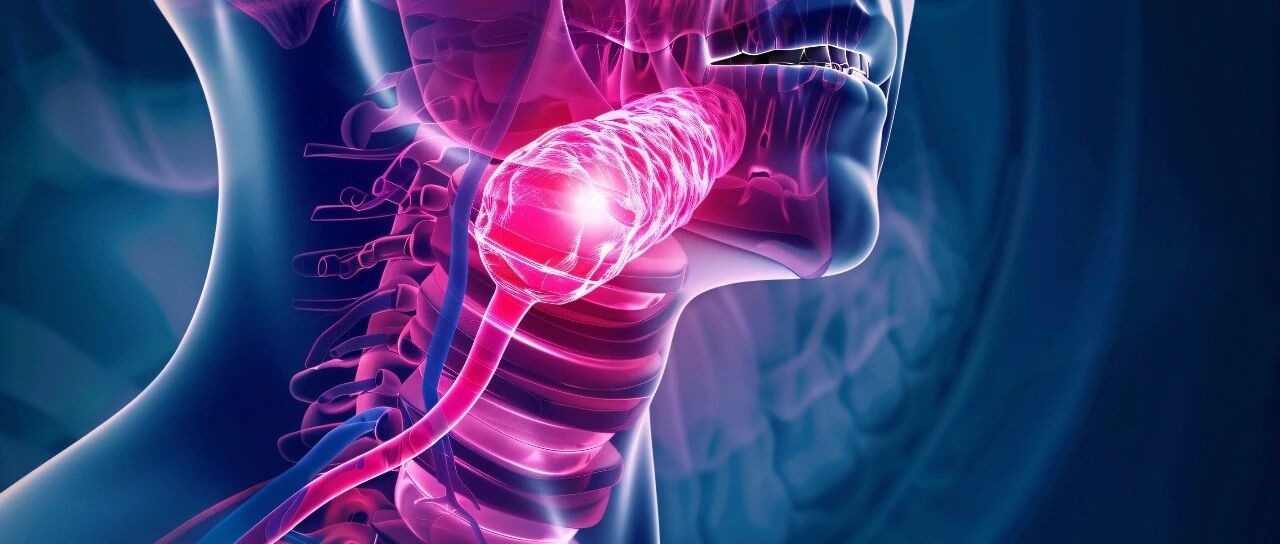 食管鳞癌新辅助治疗迎来新突破！化免方案VS放化疗，生存、复发数据全面对比