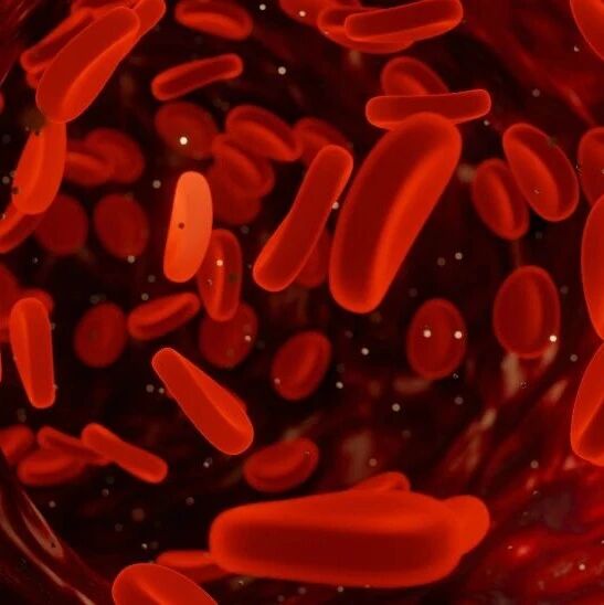 JCO丨可切除及临界可切除胰腺癌围术期VTE发生率达9%，死亡风险翻倍