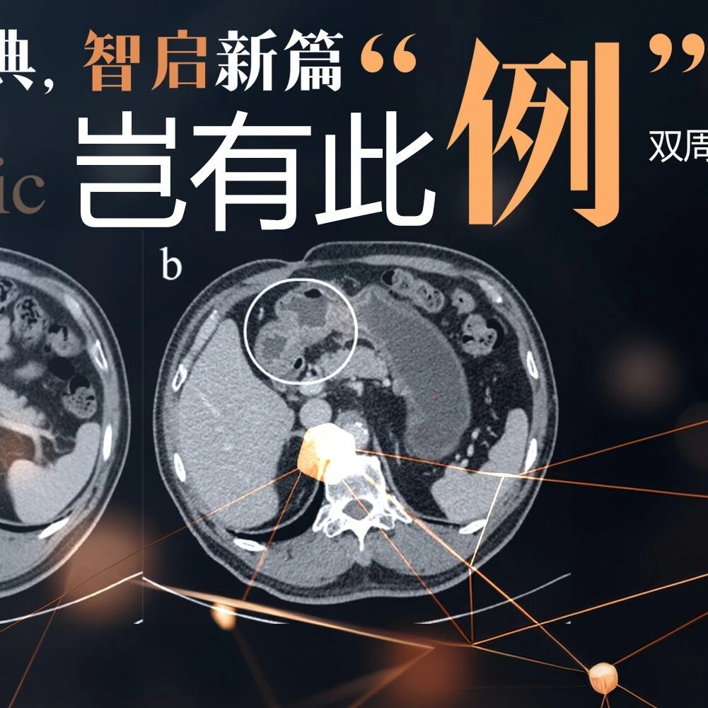 岂有此“例”｜一例pMMR/PD-L1高表达胰腺癌患者经精准多模式联合治疗获持续CR
