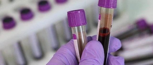 如何知道胰腺癌何时扩散到淋巴结？这种筛查方法有潜力