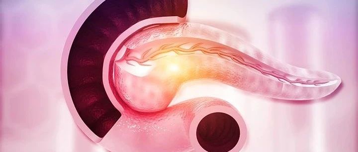 胰腺导管腺癌一线化疗方案：FOLFIRINOX方案 vs. 吉西他滨联合白蛋白结合型紫杉醇，哪个更好？