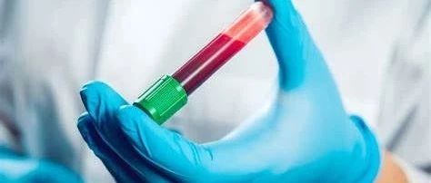 哪些胰腺导管腺癌患者可从辅助化疗中获益？血液检测或有助于识别