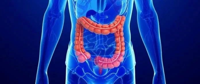 AACR 2021丨早发性结直肠癌的分子特征因种族而异