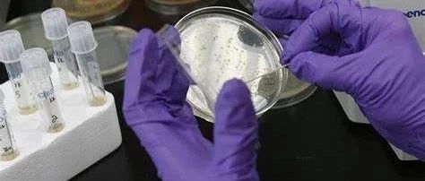 AACR 2021丨进行结直肠癌筛查，您选择粪便检测还是结肠镜检查？