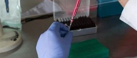 液体活检可指导结直肠癌的治疗
