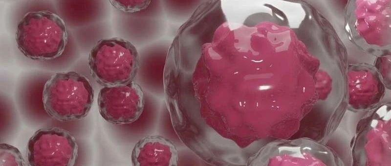 来自转移性胃癌的单细胞分析发现：两种细胞亚群与患者预后相关