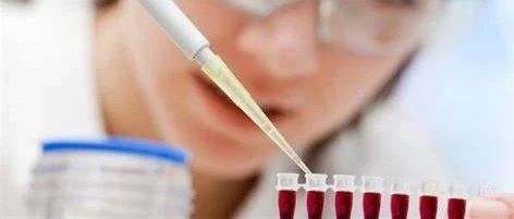 哪些胰腺癌患者对CD40免疫治疗有反应？新的生物标志物可预测