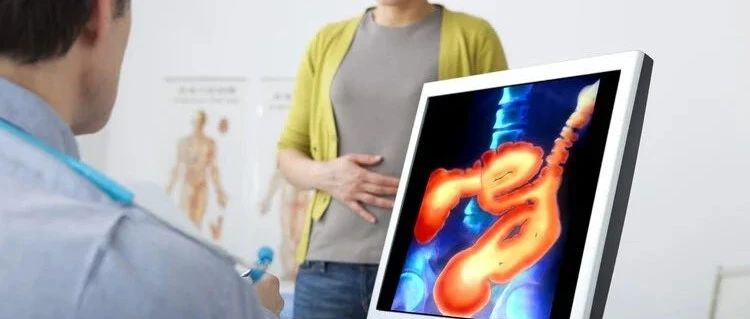 肠癌是“傻癌”，好防也好治，3个预防要点，家人也能用得上