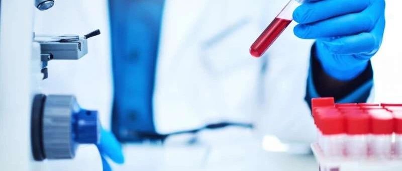验血知癌？液体活检技术助力胰腺癌及早诊断